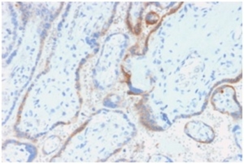 CGB3, CGB5, CGB8, NA Antibody