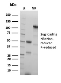 CGB3, CGB5, CGB8, NA Antibody