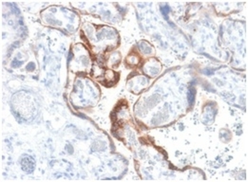 CGB3, CGB5, CGB8, NA Antibody