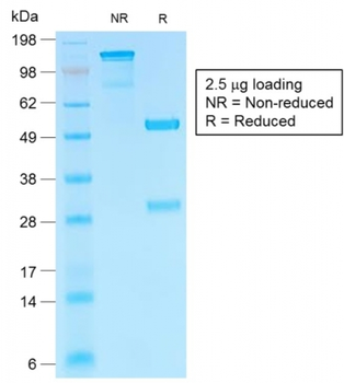 CGB3, CGB5, CGB8, NA Antibody