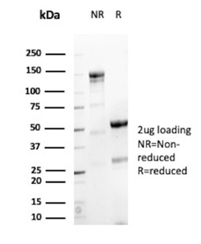 CGB3, CGB5, CGB8, NA Antibody