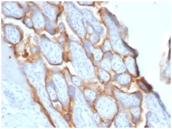 CGB3, CGB5, CGB8, NA Antibody