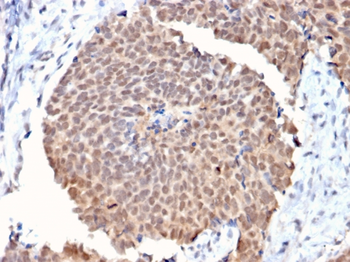 FAF1 Antibody