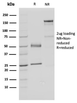 FAF1 Antibody