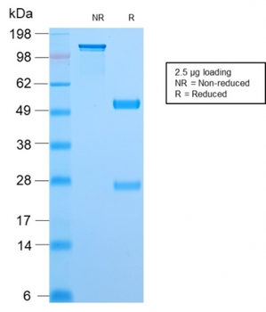 TOP1MT Antibody