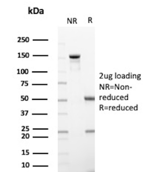 TOP1MT Antibody