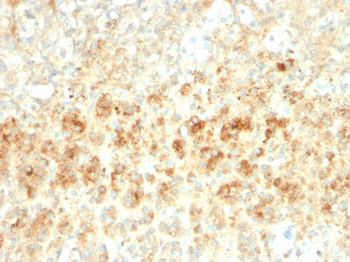 PLIN2 Antibody