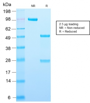 PLIN2 Antibody