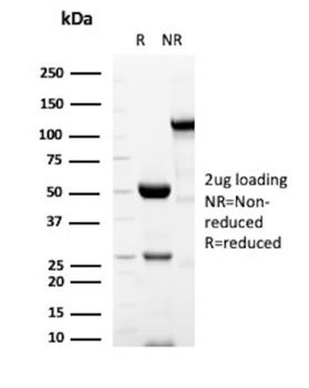 PLIN2 Antibody