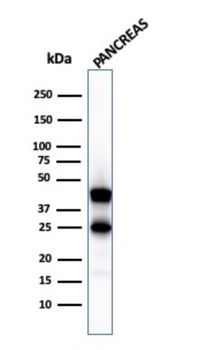 CPA1 Antibody