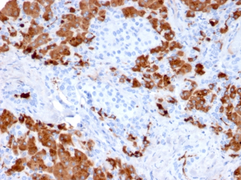 CPA1 Antibody