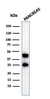 CPA1 Antibody