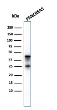 CPA1 Antibody