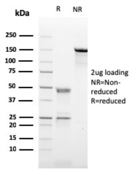 CR2 Antibody