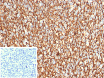CR2 Antibody