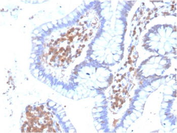 MAPK14 Antibody