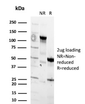 CTNNB1 Antibody