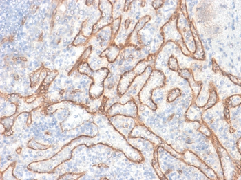 CTNNB1 Antibody