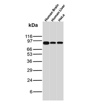CTNNB1 Antibody