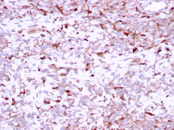 CTSK Antibody