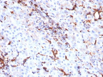 CTSK Antibody