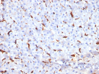 CTSK Antibody