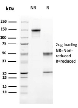 CTSK Antibody