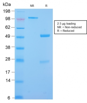 DES Antibody