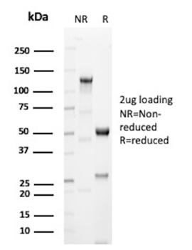 DES Antibody
