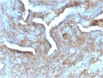TYMP Antibody