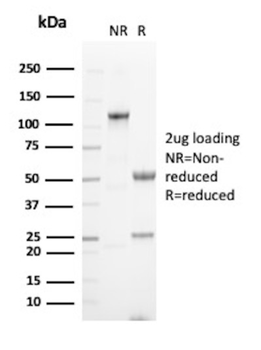 TYMP Antibody