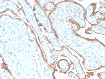 EGFR Antibody