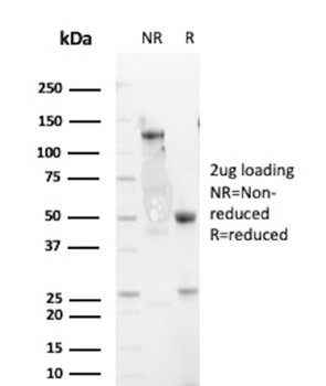 EGFR Antibody