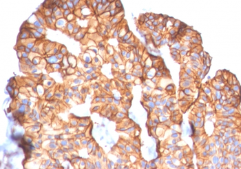 ERBB2 Antibody