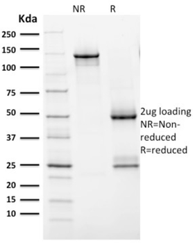 ERBB2 Antibody
