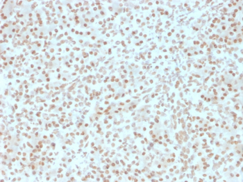 AKT1 Antibody