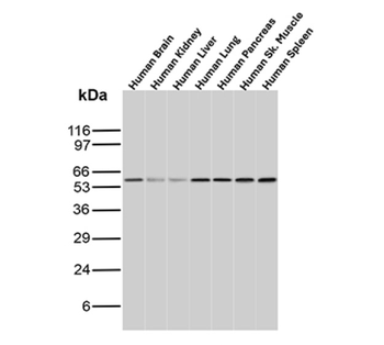AKT1 Antibody