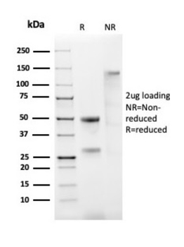 ESR1 Antibody