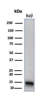 FABP5 Antibody