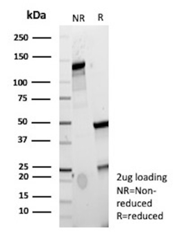 FABP5 Antibody