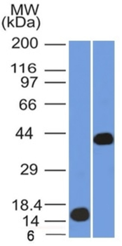 AMACR Antibody