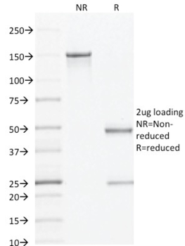 AMACR Antibody