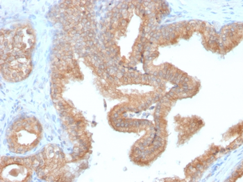 AMACR Antibody