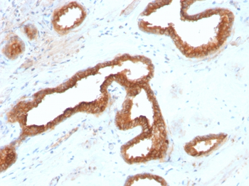 AMACR Antibody