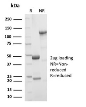 AMACR Antibody