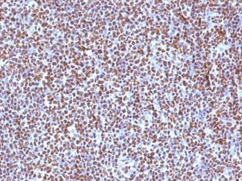 ALK Antibody