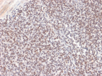 ALK Antibody