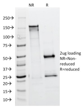 ALK Antibody