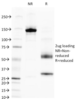 ALPL Antibody