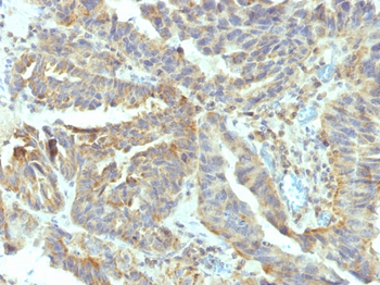 ALPL Antibody